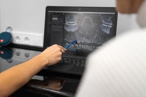 Zahnarzt zeigt dem Patienten ein 3D-Bild des Kiefers auf dem Laptopbildschirm