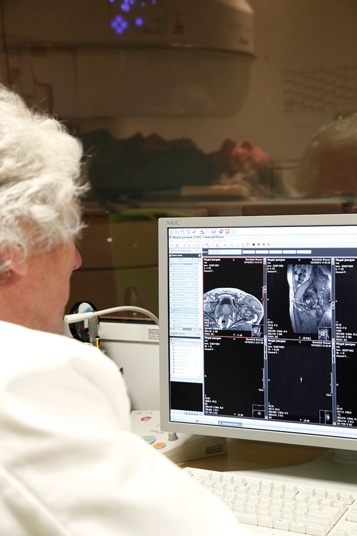 Ein Arzt kontrolliert ein offenes MRT